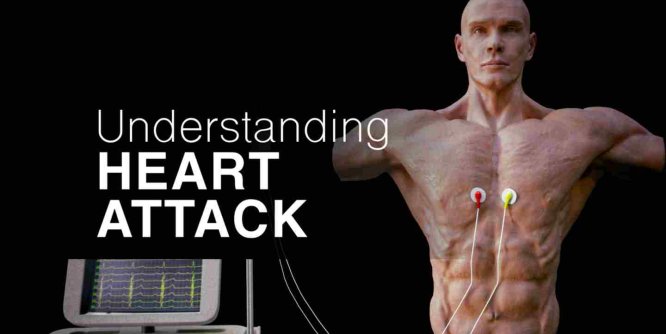 Meta Quest 游戏《了解心脏病》Understanding Heart Attack-魔趣网精选